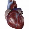https://medipraxcentrum.ro/s/wp-content/uploads/2014/06/cardiopatia-ischemica-100x100.jpg